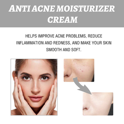 Eelhoe Brightening Acne Repair Cream — Hydrating & Redness Relief