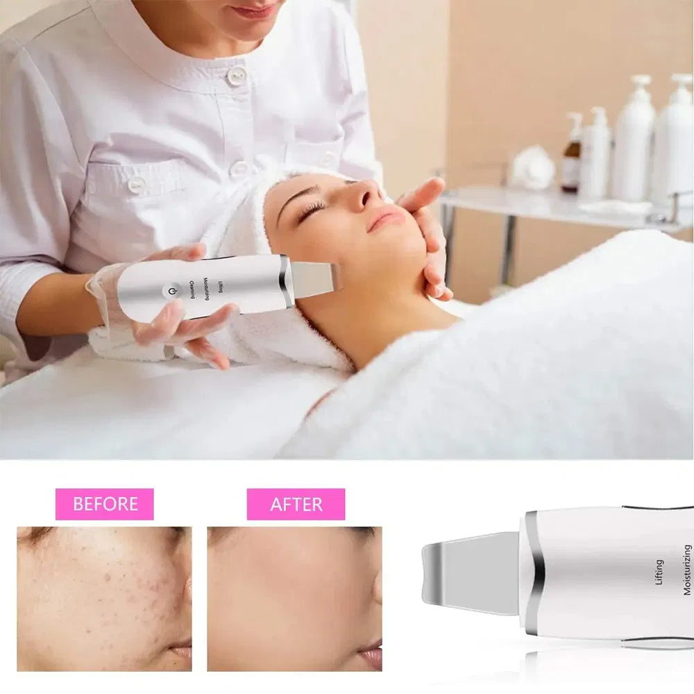3-in-1 Ultrasonic Skin Scrubber — Deep Cleansing Facial Spatula