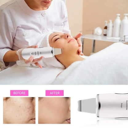 3-in-1 Ultrasonic Skin Scrubber — Deep Cleansing Facial Spatula