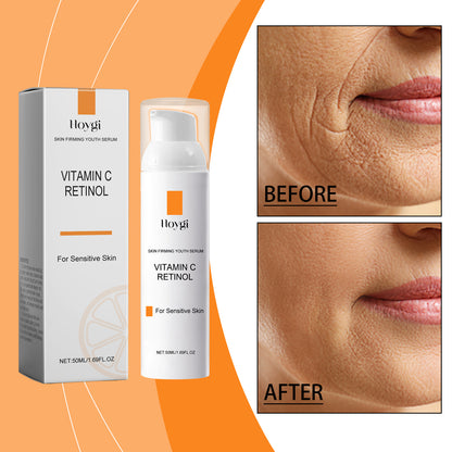 Vitamin A & C Glow Serum — Pore-Minimizing & Wrinkle-Smoothing