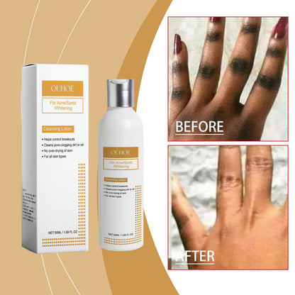 OUHOE Hydrating Facial Cleansing Lotion — Oil Control & Nourishing